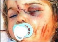 /album/fotogalerij/image-20-jpg/